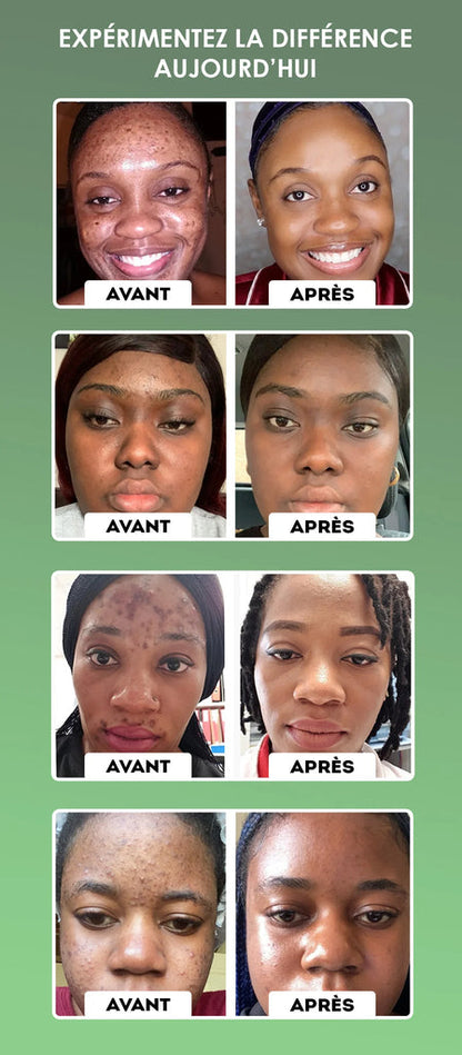 Masque Stick Purifiant au Thé Vert - Pour une Peau Nette et Sans Imperfections